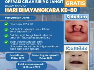Semarak Hari Bhayangkara ke-80, Polda Banten Gelar Donor Darah dan Khitanan Gratis